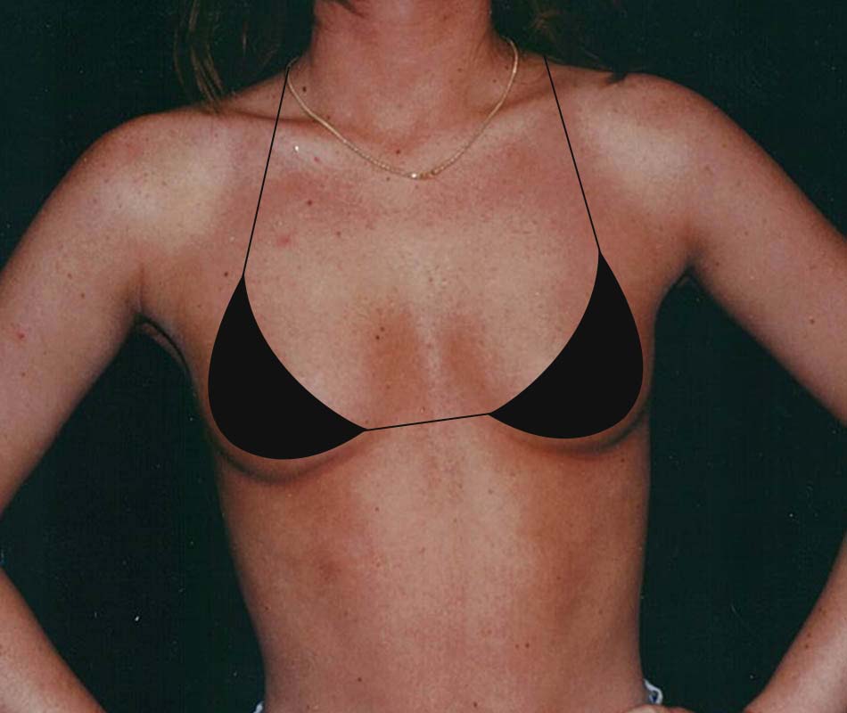 Before Results