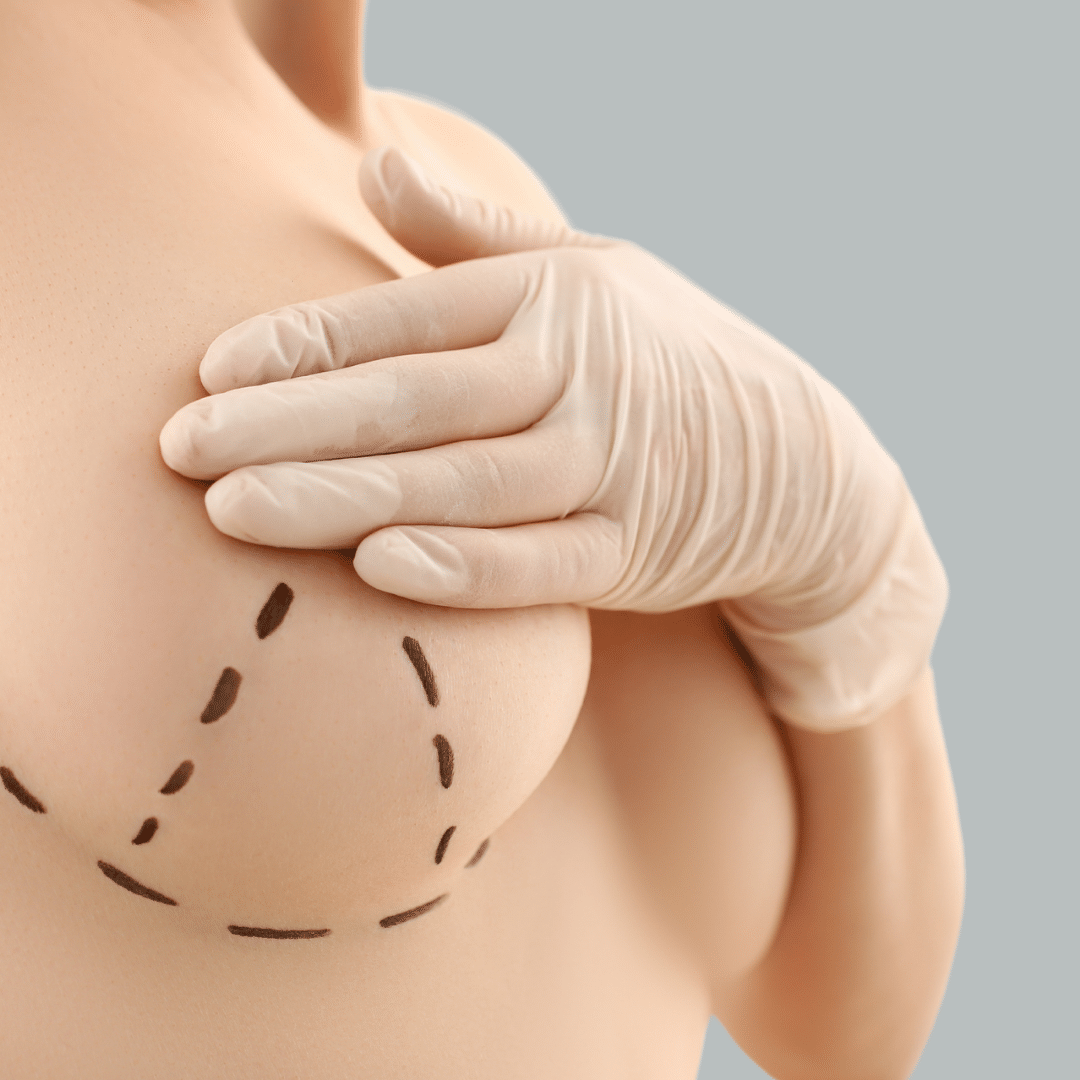 Breast lift sub page