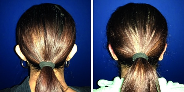 Before and after photo of a woman's ponytail with hair extensions.