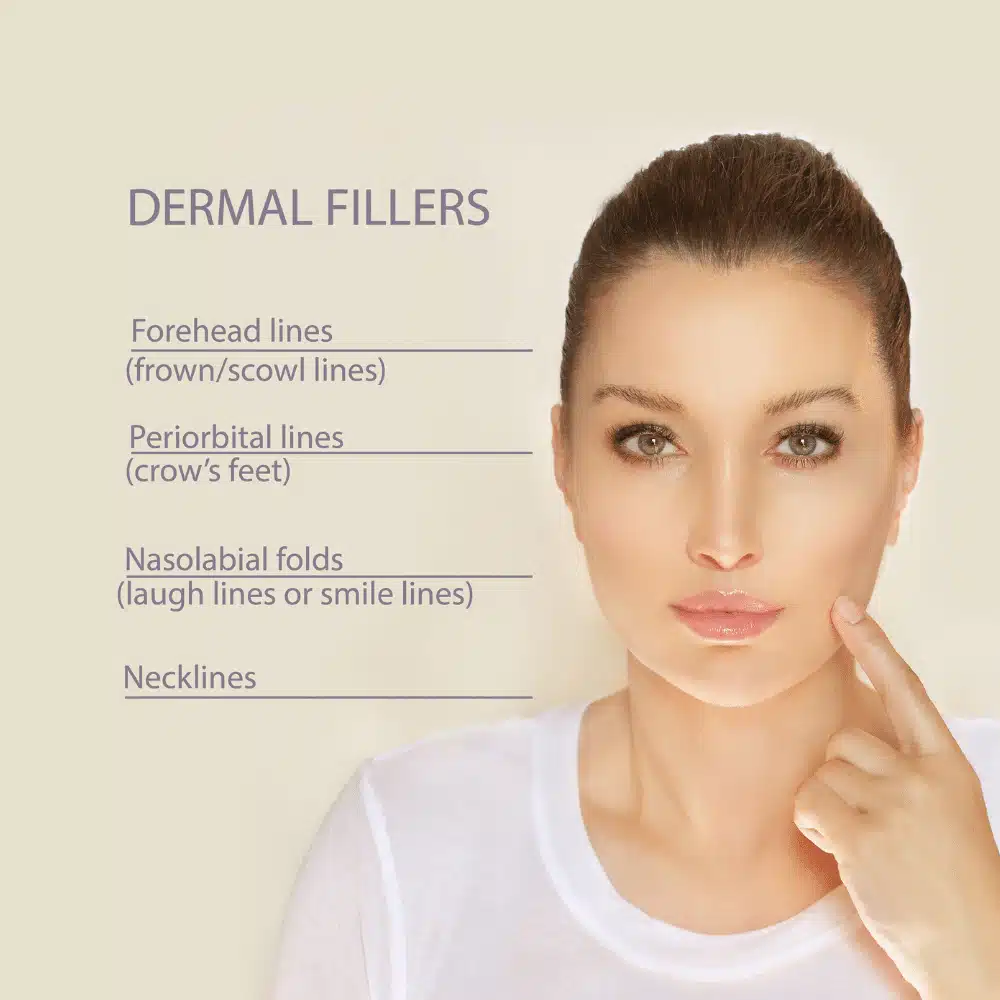 A woman's face is shown with different types of dermal fillers.